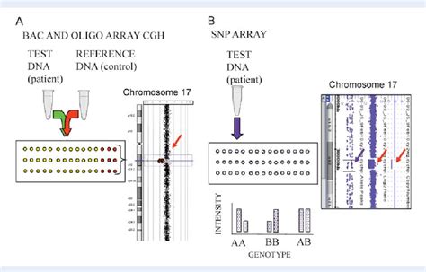 Snp Microarray Test Labcorp