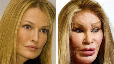 so much plastic surgery