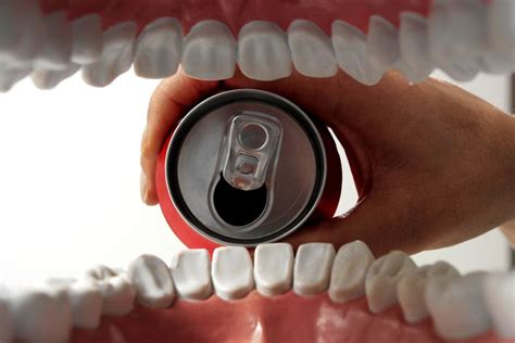When Can I Drink Soda After Tooth Extraction?