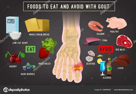 Soft Drinks Gout