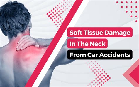 soft tissue damage in neck from car accident