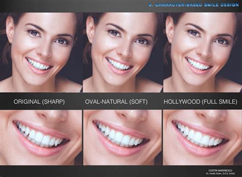 soft vs sharp features