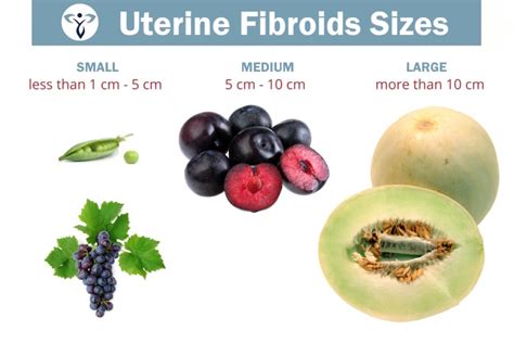 Softball Size Fibroid