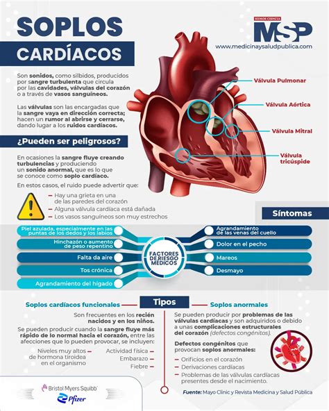 Understanding Soplo en el Corazon: What You Need to Know About Heart Murmurs