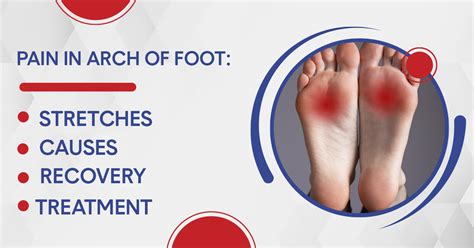 Sore Foot Arch: Causes, Relief, and Effective Home Remedies