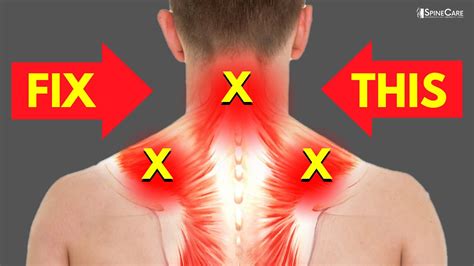 soreness in back of neck and shoulders