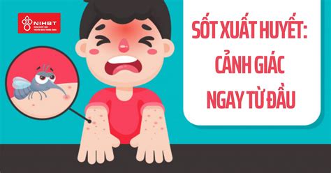 sot xuat huyet in english