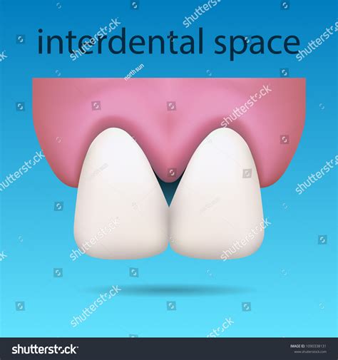 Space Between Teeth Definition