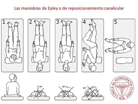 spanish epley maneuver pdf