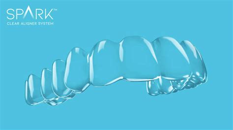 Orthodontic News Spark Aligners Does It Again with Market Leading