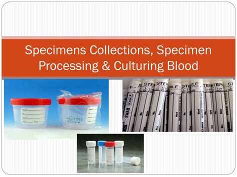 Specimen Processing Meaning