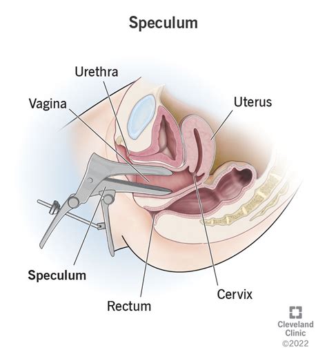Speculum How Does It Work