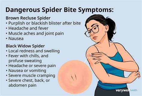 Spider Bites Symptoms: What You Need to Know to Protect Yourself