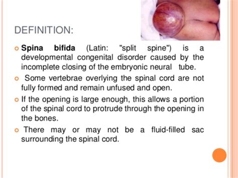 spina bifida is defined as quizlet