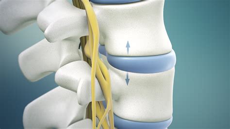 spinal cord surgery success rate