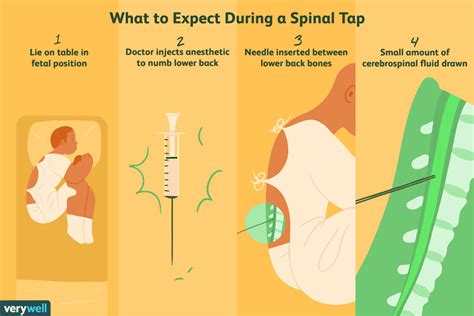 Spinal Tap For C Section Side Effects