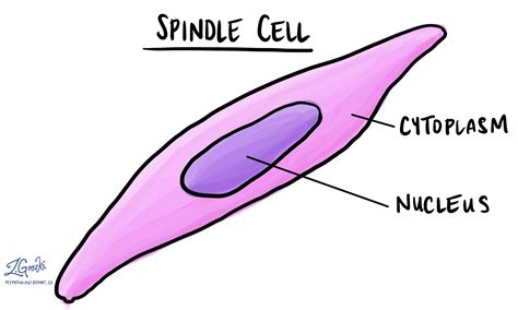 Spindle Cell Neoplasm Meaning