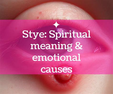 spiritual meaning of eye stye