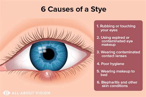 spiritual meaning of stye in left eye