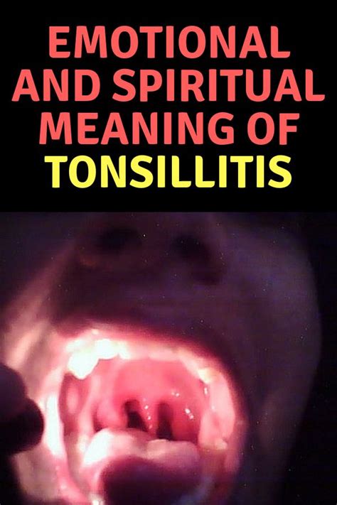 spiritual meaning of tonsillitis