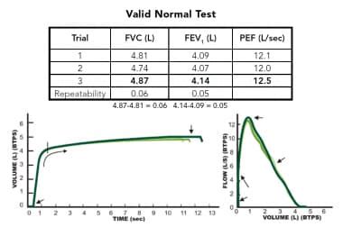 Spirometer Average Results