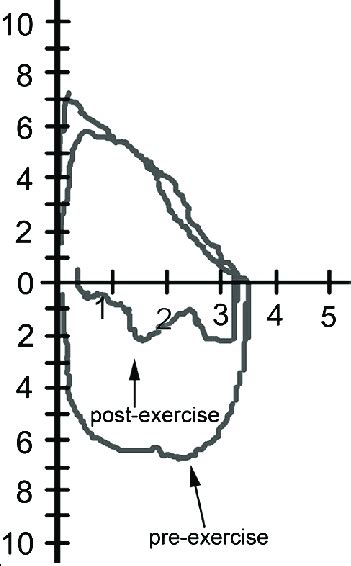 Spirometry Before And After Exercise