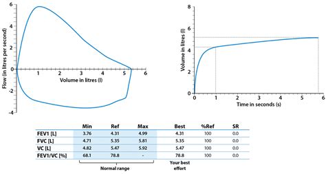 Spirometry Reading