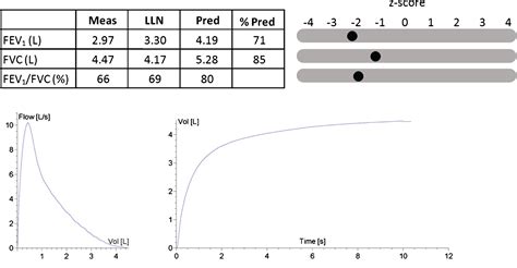 Spirometry Reference Ranges