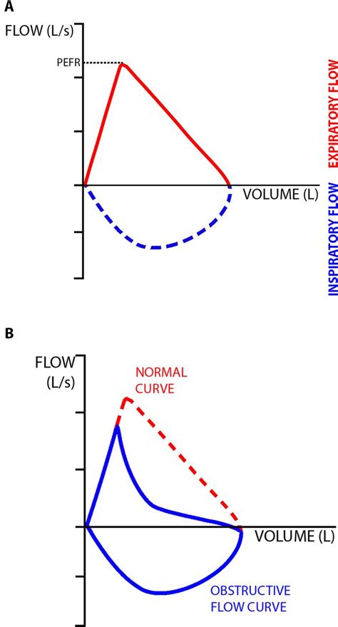 Spirometry Results With Asthma