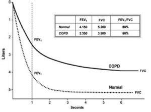 Spirometry Values In Copd