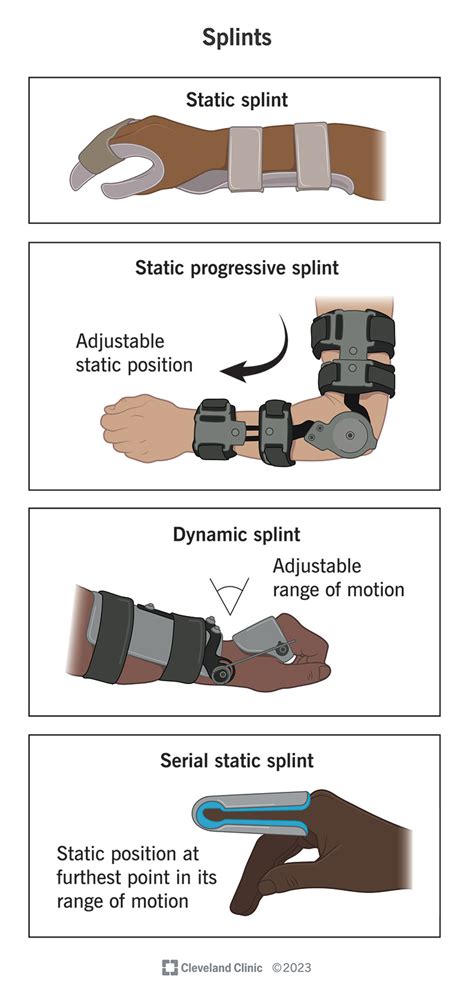 Splint Emt Use