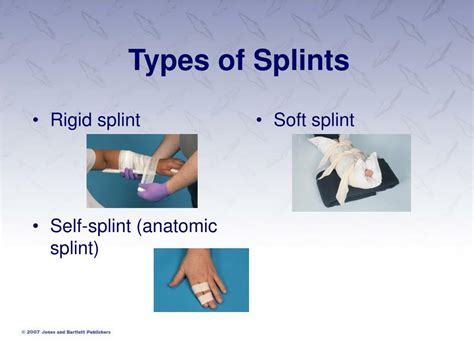 Splint Vs Splinter