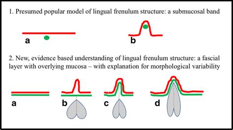 [DIAGRAM] Split Frenulum Diagram