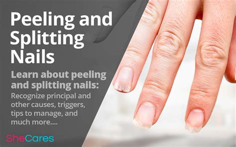 splitting cracking peeling nails