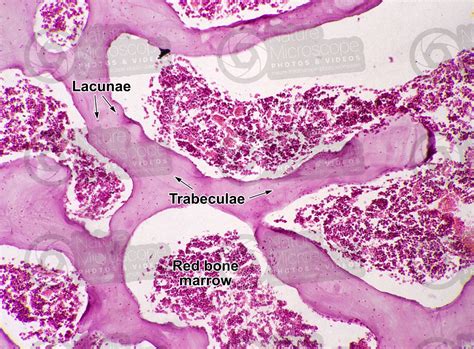 spongy bone tissue under microscope