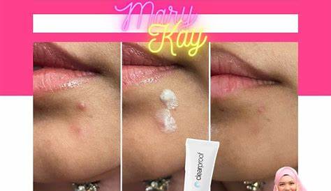 Mary Kay Acne Spot Solution Testimoni & Review Cara