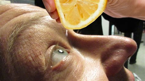 Squeezing Lemons in Eyes