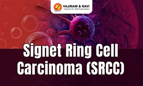 srcc cancer