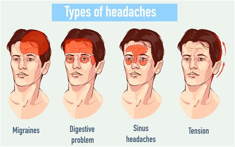 stabbing headaches top of head