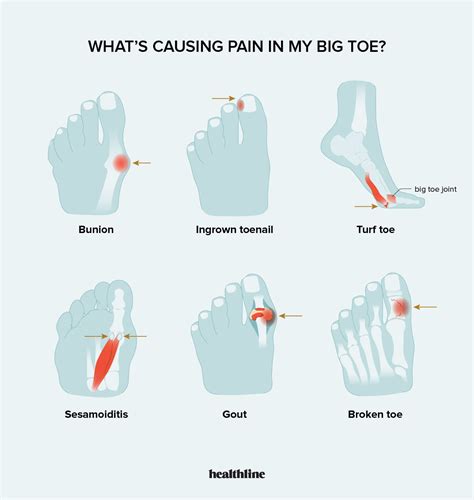 stabbing pain in left big toe
