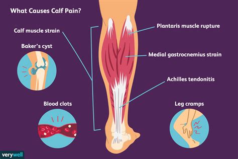 stabbing pain in left calf muscle