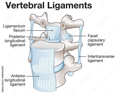 Effective Natural Remedies for Treating Spondylolisthesis