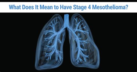 Mesothelioma Survival Rates & Statistics by Age, Gender, & Race
