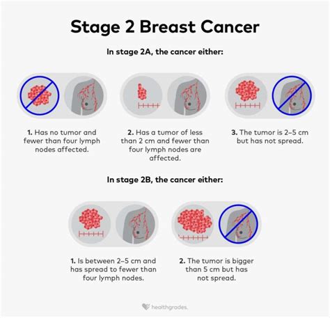stage 2 terminal cancer