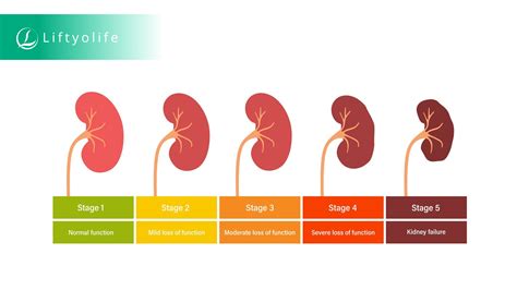 stage 3 kidney disease