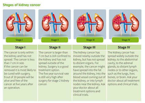 stage 4 clear cell renal cancer prognosis