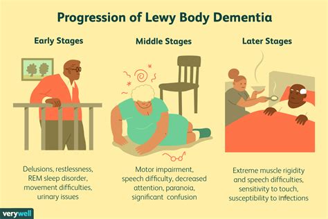 stages of lewy body dementia with parkinson's