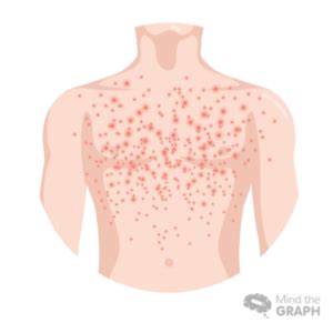 Staph Infection Chest