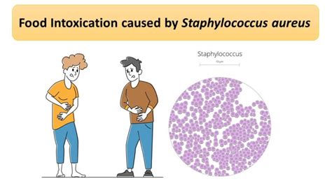 Staphylococcal food poisoning meaning in english