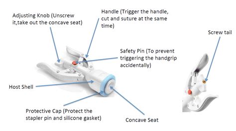 Stapler Circumcision Meaning